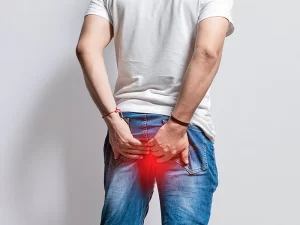 درمان هموروئید داخلی