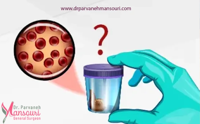 علل رایج وجود خون در مدفوع