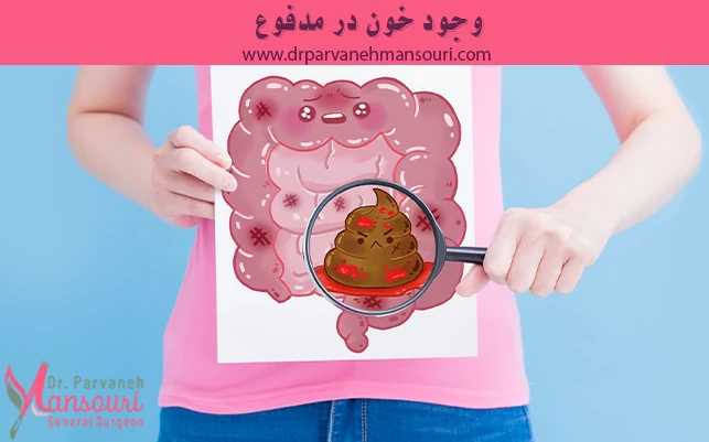وجود خون در مدفوع