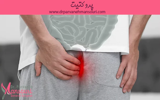 پروکتیت