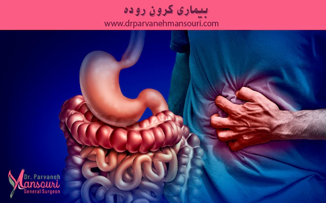 بیماری کرون روده