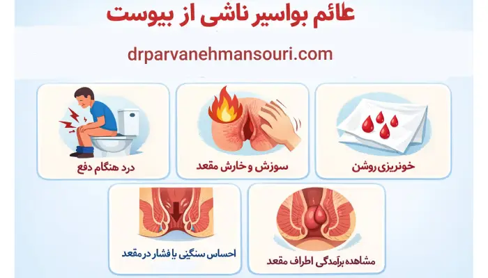 آیا یبوست باعث بواسیر می شود؟
